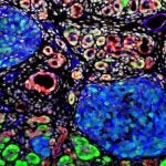 Tuveson pancreatic immunofluorescence CA19-9
