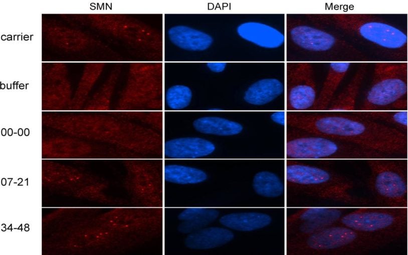 antisense oligonucleotides ASO