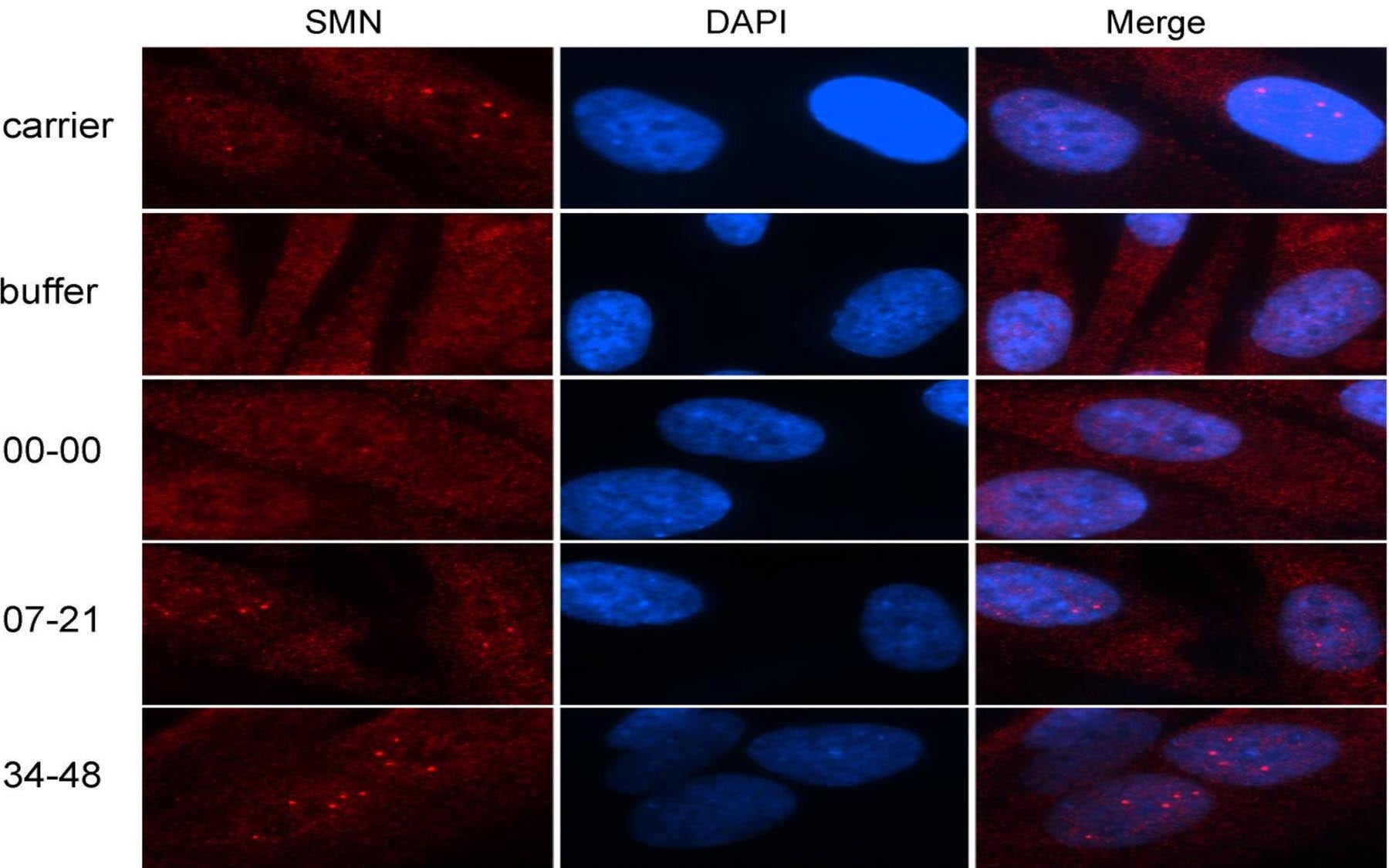 antisense oligonucleotides ASO