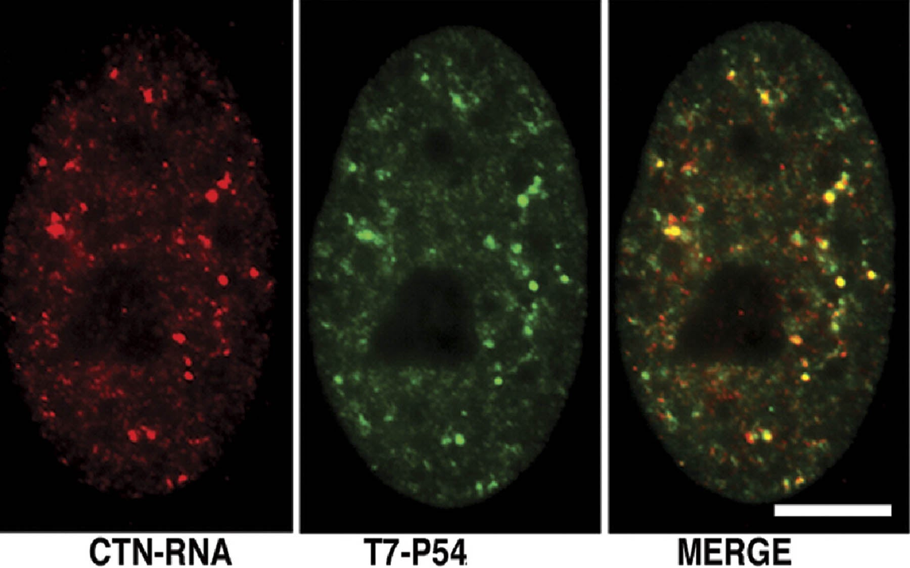 CTN-RNA paraspeckles