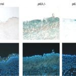 dorsal back skin biopsies