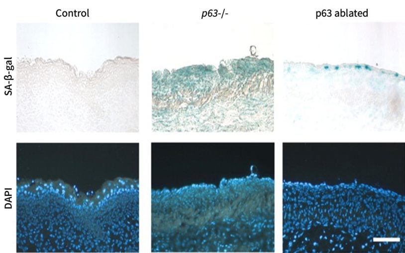 dorsal back skin biopsies