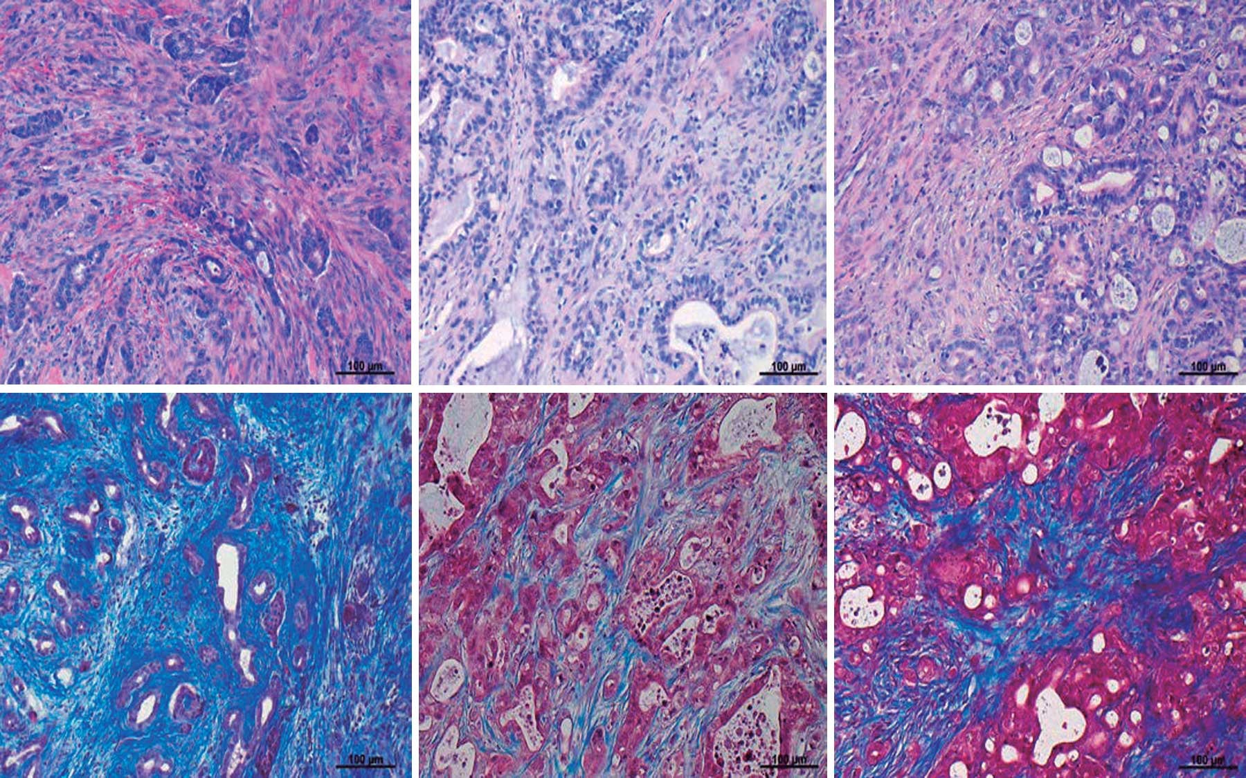 tumors in organoid mouse models