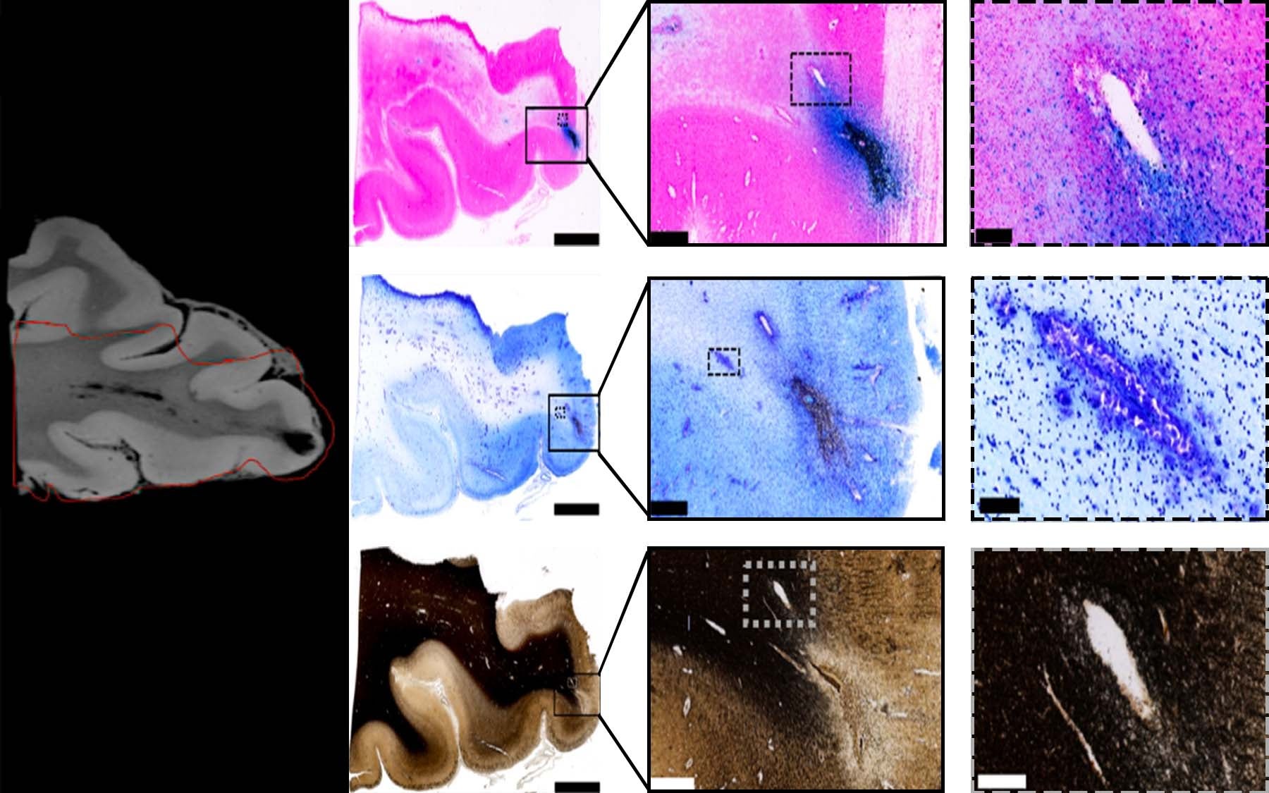 Photo of Brain injury Mitra