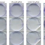 mutated cancer cells