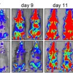 photo of SIK3 blocking leukemia in mice