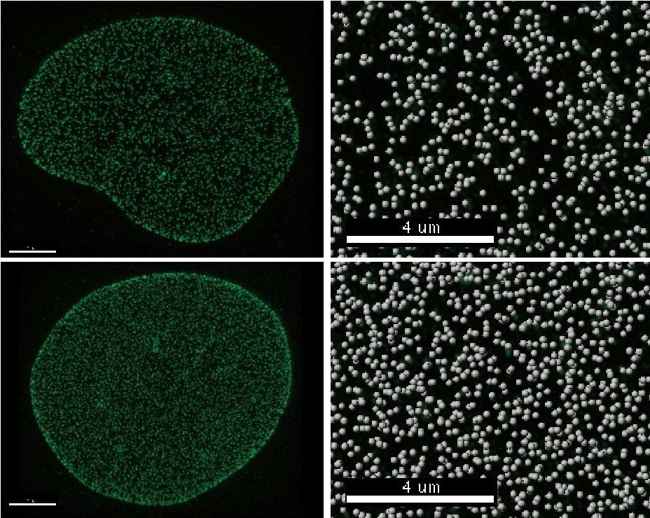 image of Tpr protein
