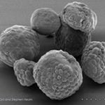 electron microscopy image of organoids