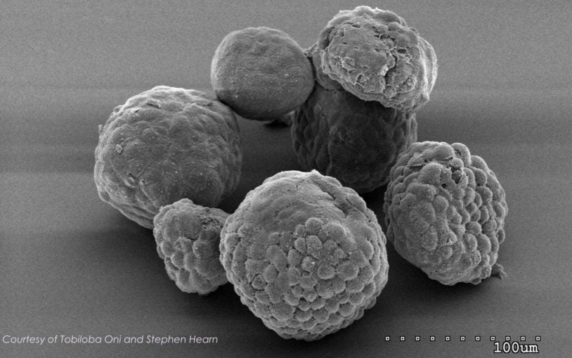 electron microscopy image of organoids