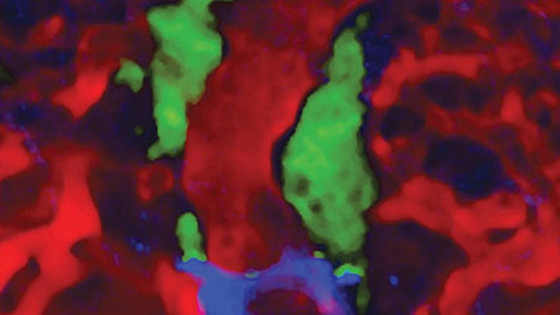 image of metastatic cells in a mouse model of breast cancer