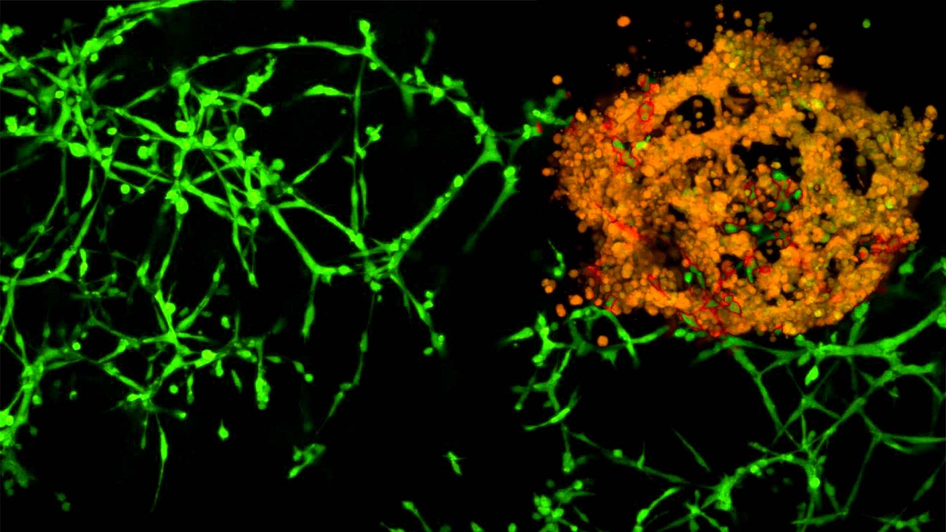 image of 3D composite of triple negative breast cancer cells