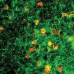 image of abnormal behavior of PV neurons in mouse brain