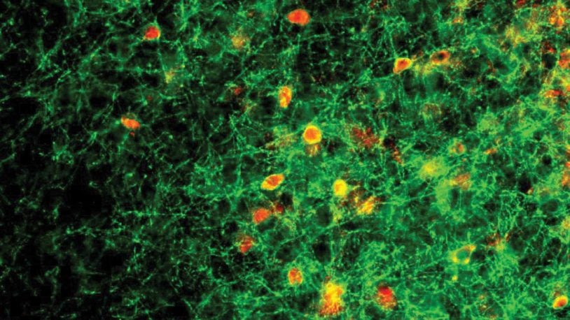 image of abnormal behavior of PV neurons in mouse brain