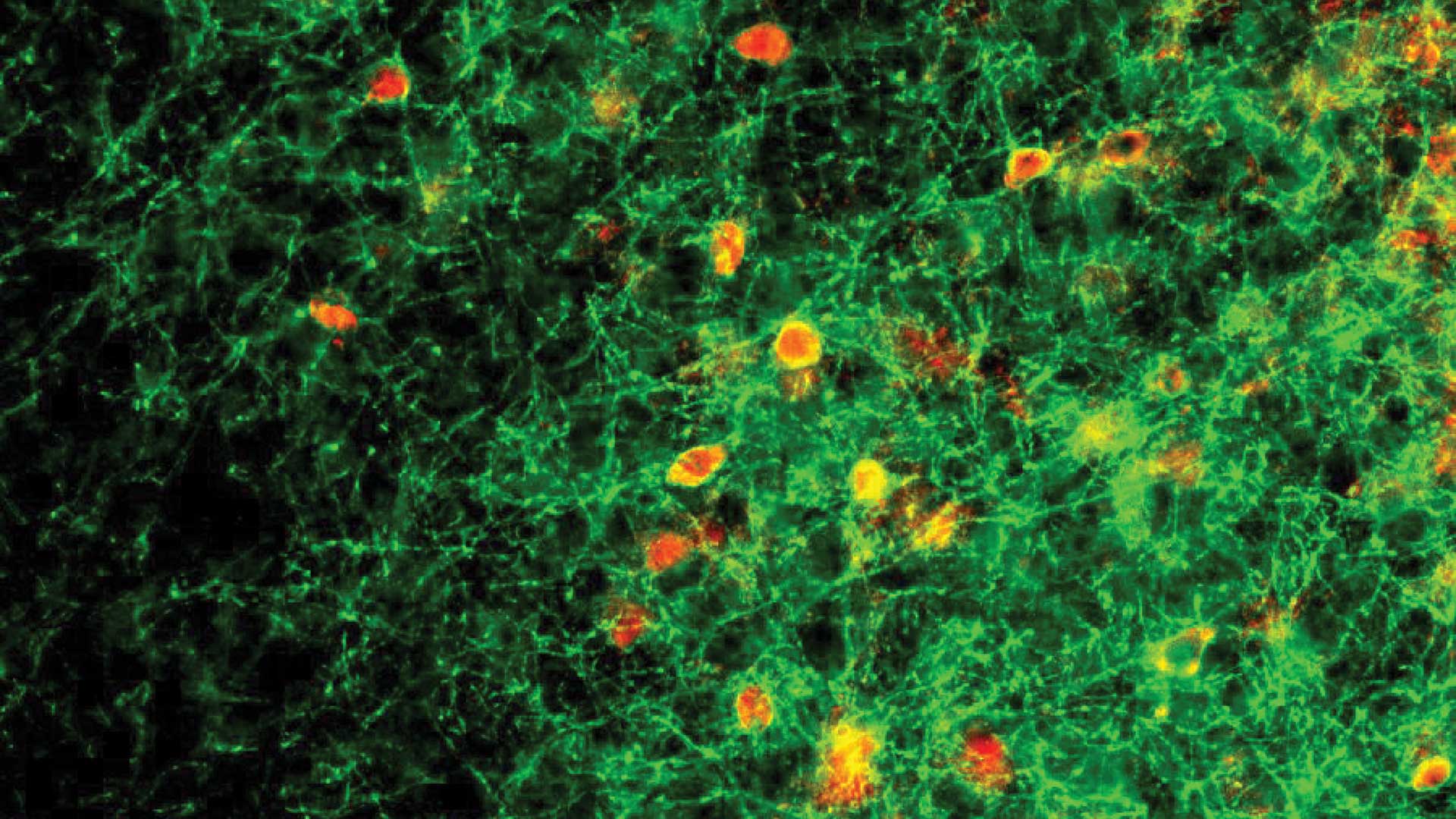 image of abnormal behavior of PV neurons in mouse brain
