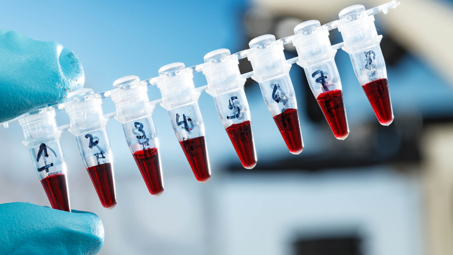 PCR Laboratory Set-up