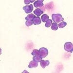 image of immature blood cells