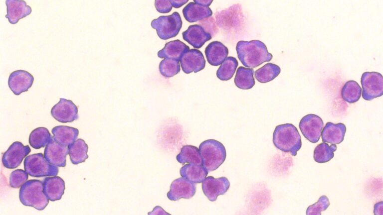 image of immature blood cells