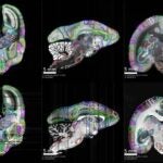 image of brain mapped neural connections