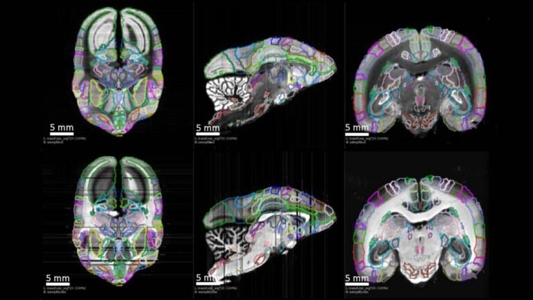 image of brain mapped neural connections