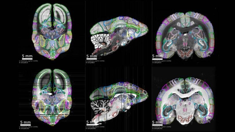 Detailed new primate brain atlas could lead to disease insights