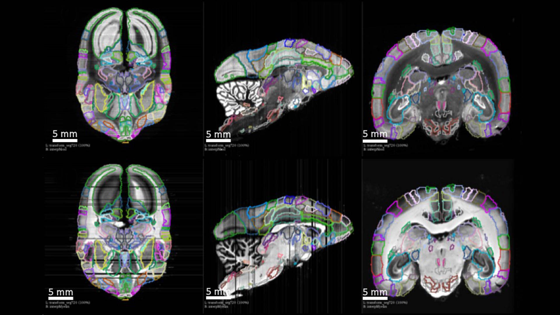 image of brain mapped neural connections