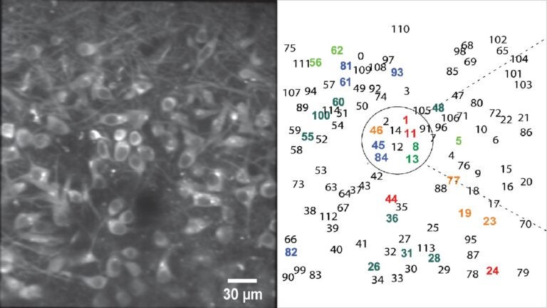 image of mitral cells and position chart