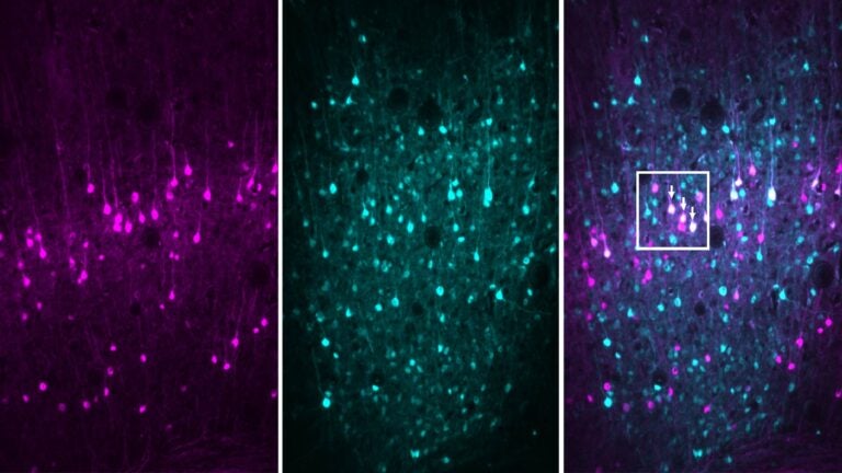 image of stained mouse neurons