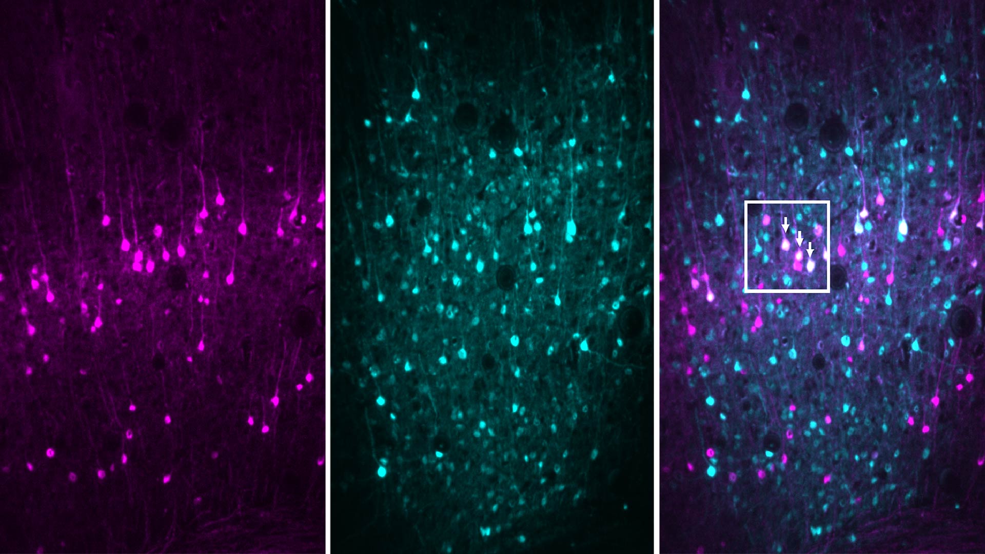 image of stained mouse neurons