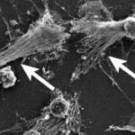 scanning electron microscopy image of neutrophils forming NETs
