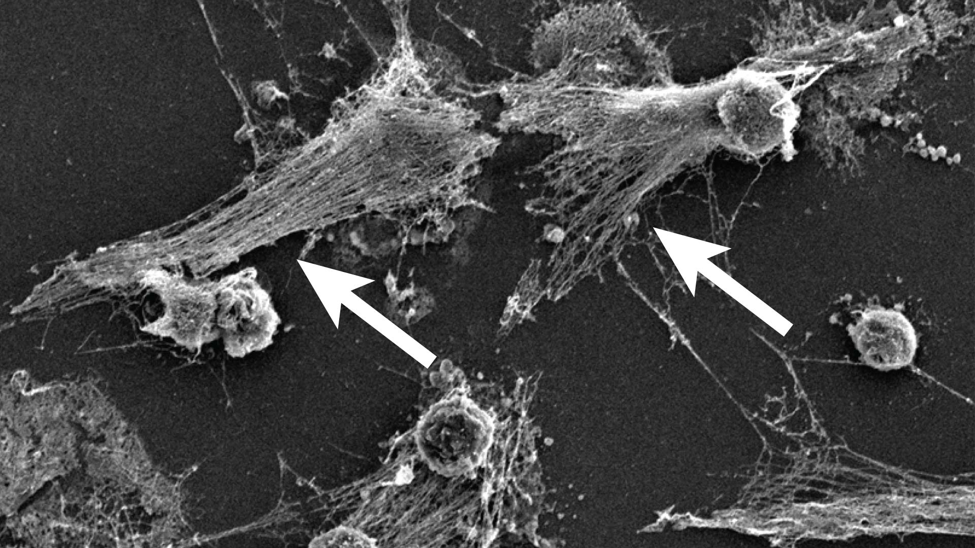 scanning electron microscopy image of neutrophils forming NETs