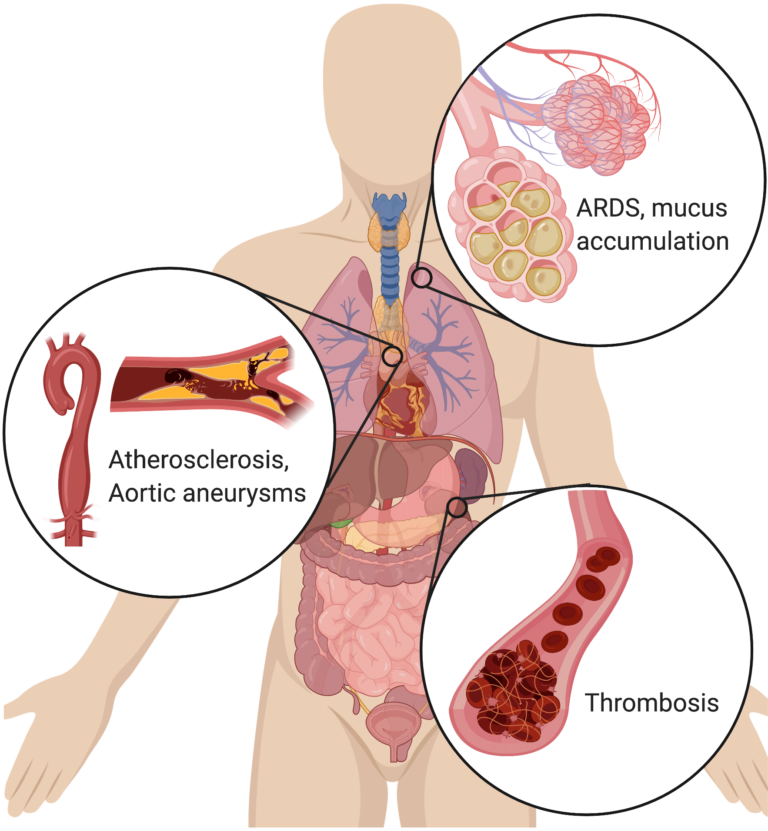 illustration of human body with callouts indicating several severe pathologies