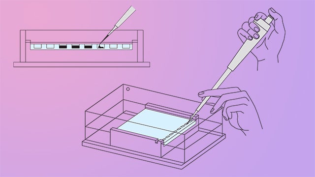 Gel electrophoresis hero image