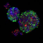 graphic of breast organoids