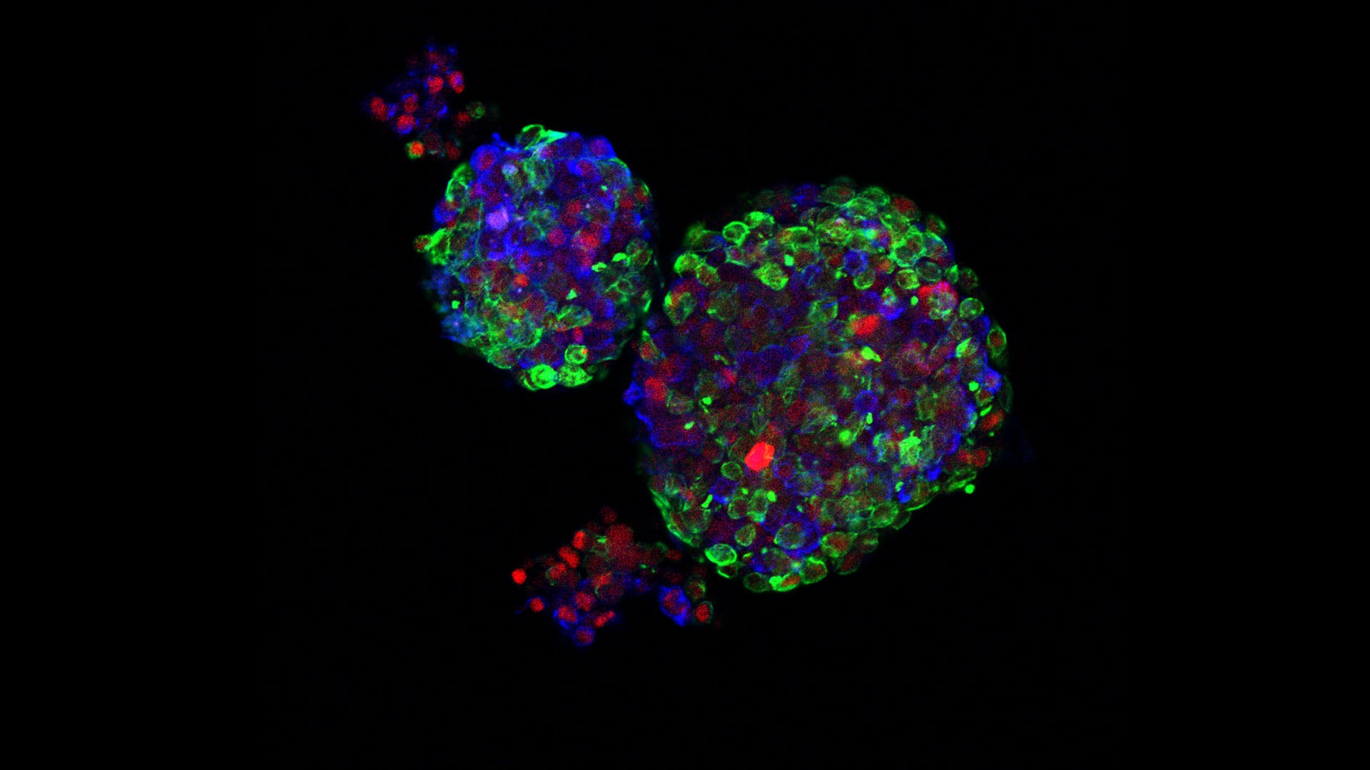 graphic of breast organoids