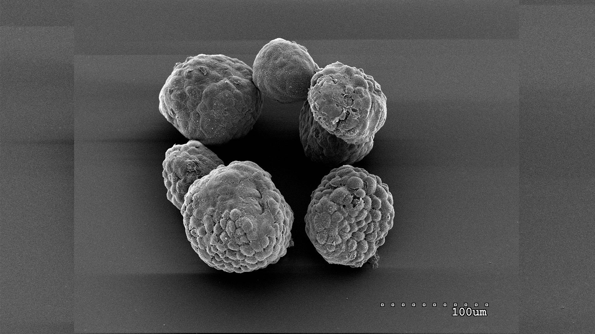 image of pancreatic tumor organoids in mouse