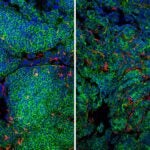 photomicrographs of mouse tumors