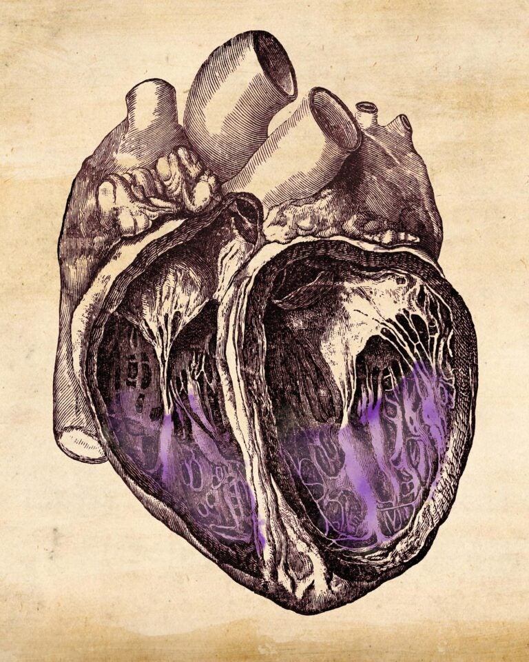 etching of heart