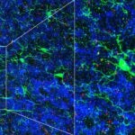 image of microglia cells in brain