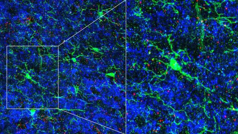 image of microglia cells in brain