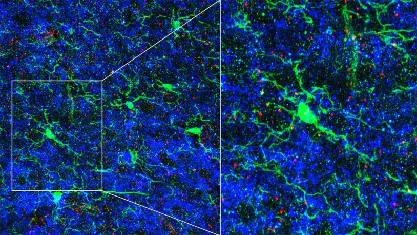 Immune cells sculpt circuits in the brain