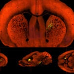 image of mouse brain motivational center