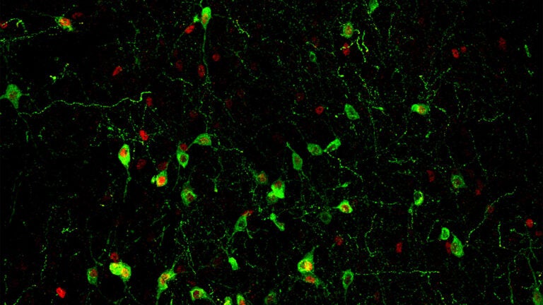 image of a section of mouse brain stained to show the insomnia