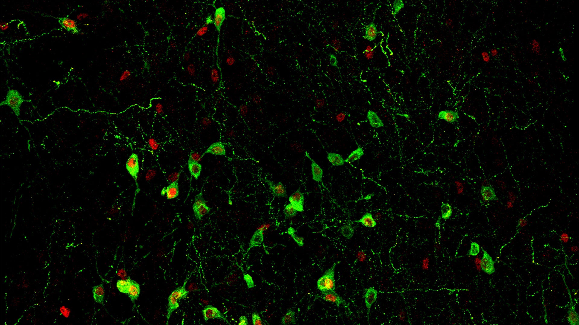 an image of a section of mouse brain stained to show the insomnia