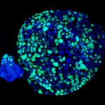 image of pancreas tumor organoids