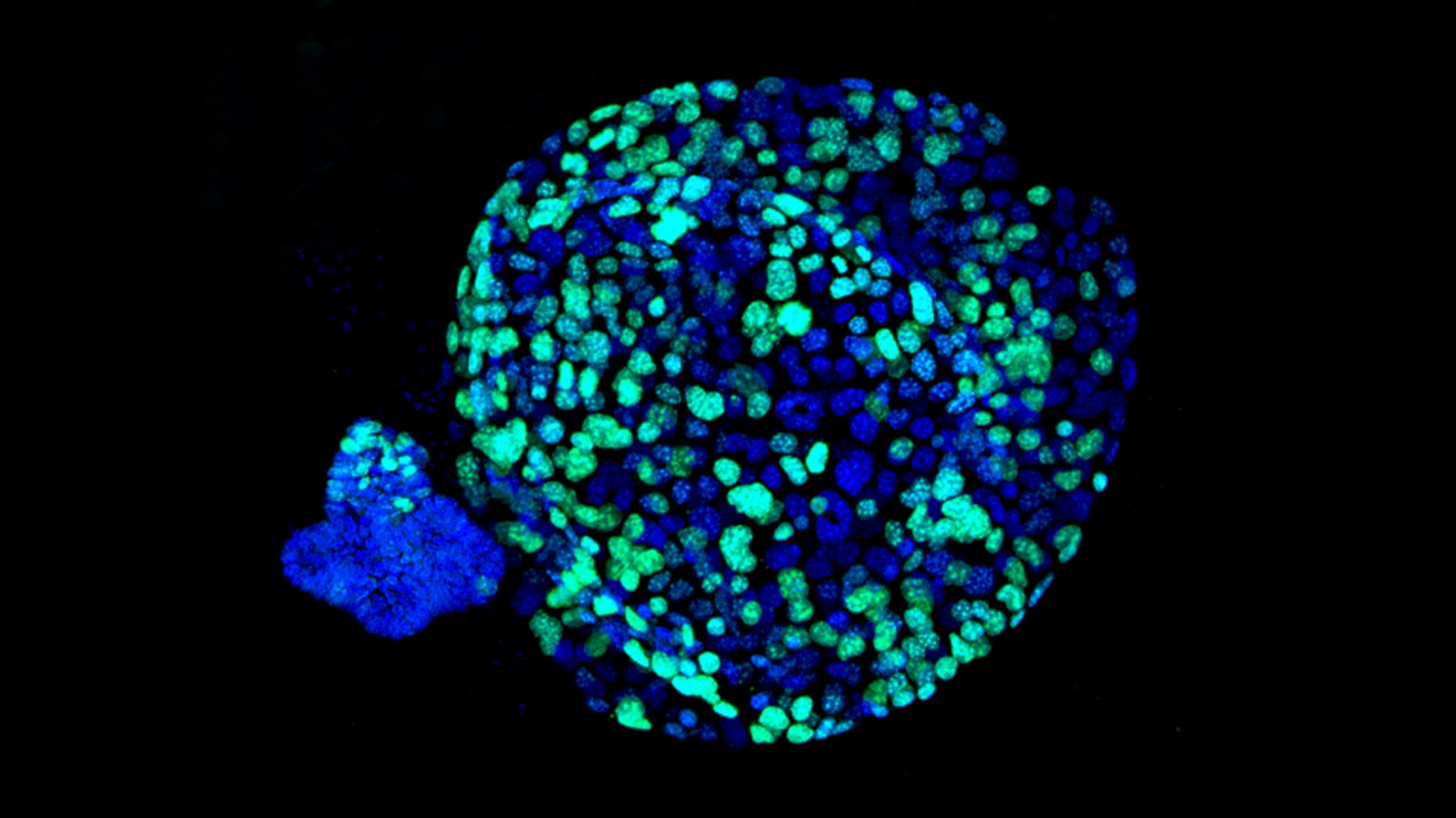 image of pancreas tumor organoids