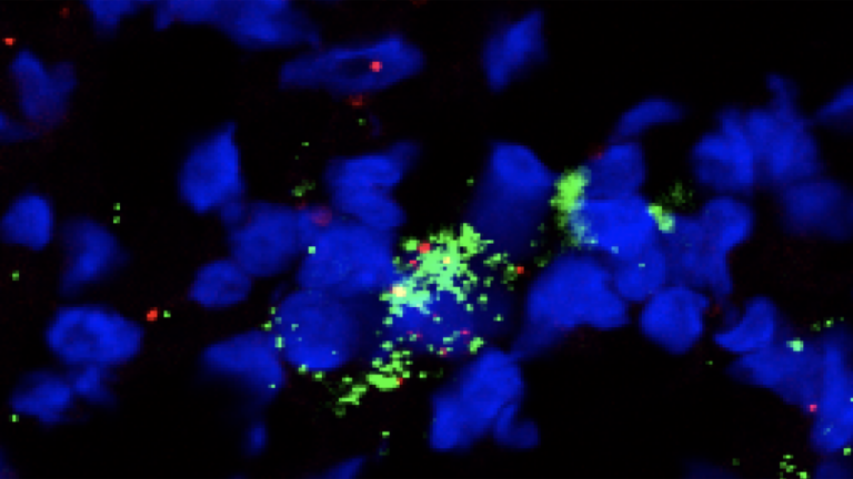 image of a fibroblastic reticular cell