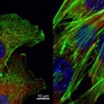 image of cancer cell movement and metastases