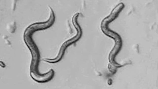 microscopic photo of c. elegans worms