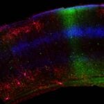 electron microscopy image of chandelier cells in a mouse brain