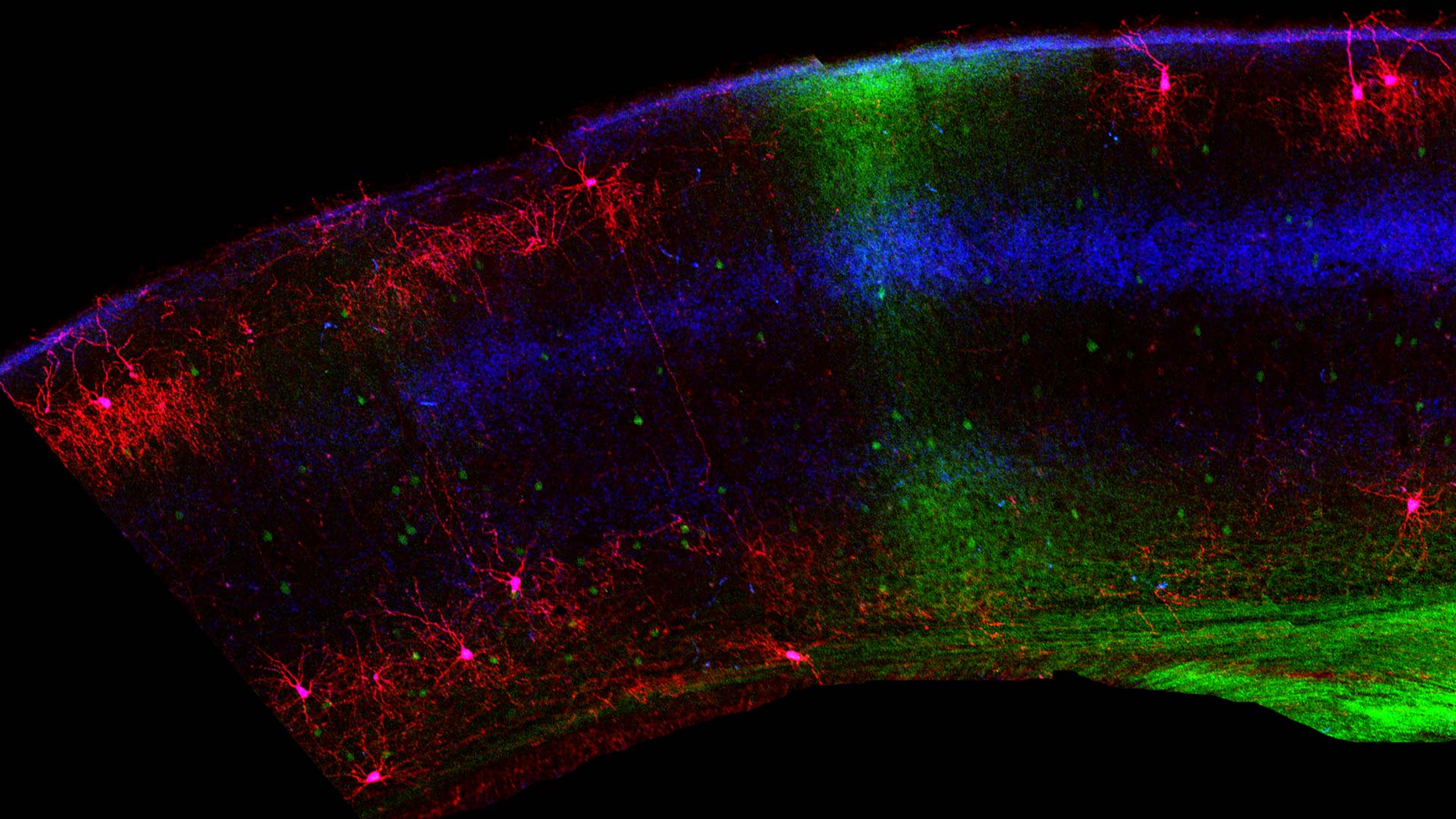 electron microscopy image of chandelier cells in a mouse brain